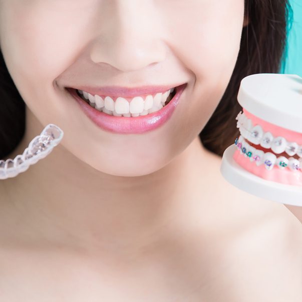 invisalign