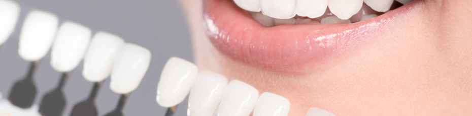 facts about porcelain veneers