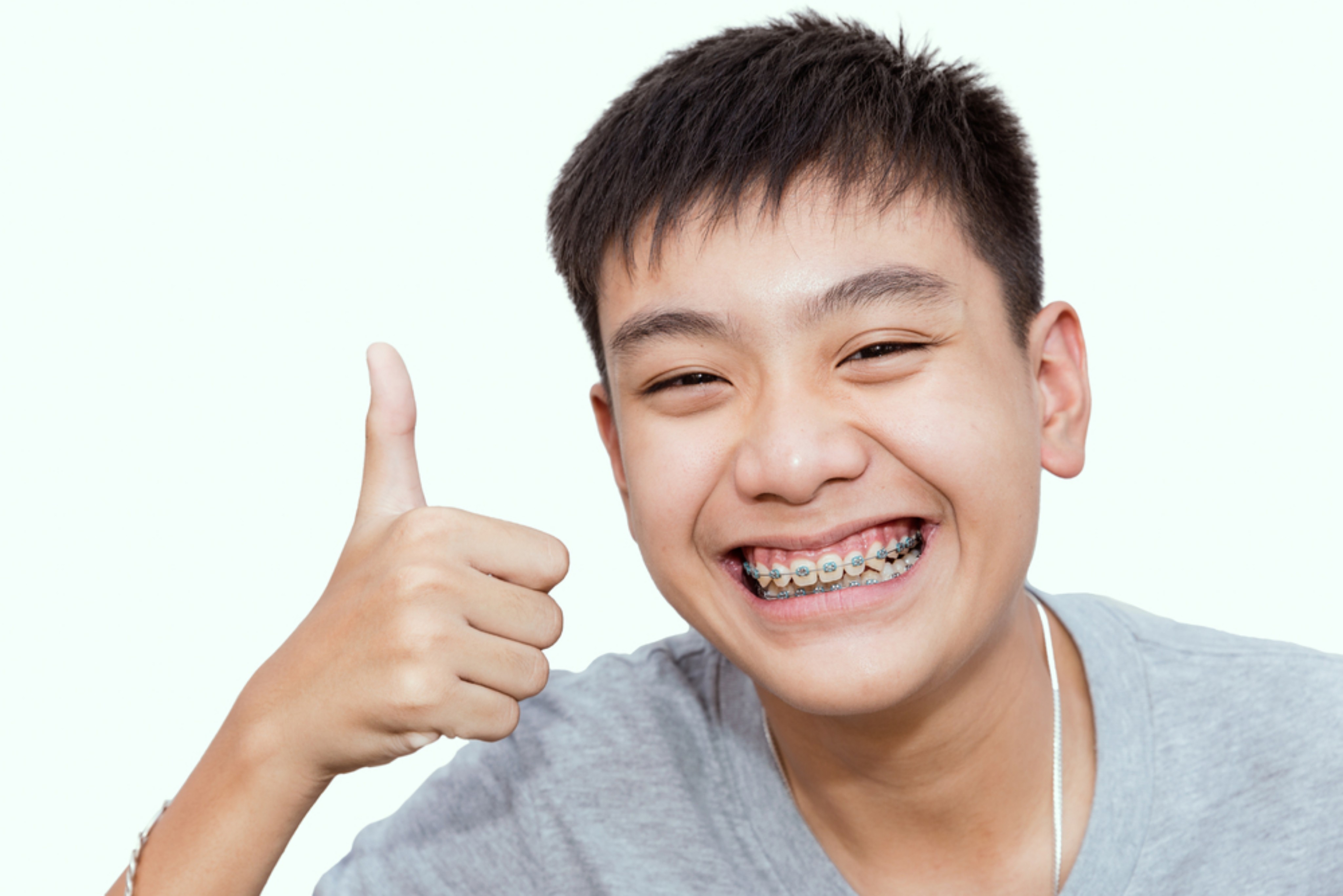 5 things you should remember while wearing braces