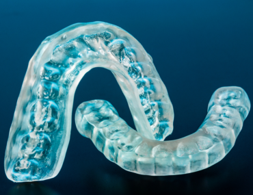 living with invisalign some important facts you need to know